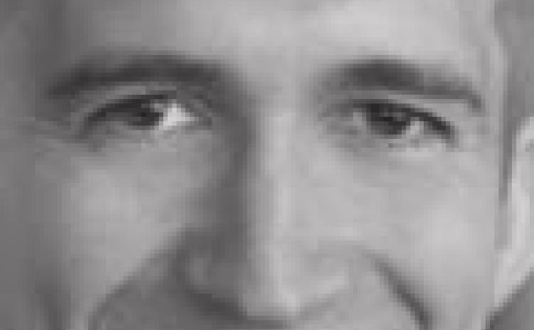 Floaters caused by age related changes